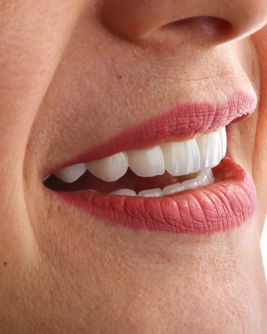 Sorriso de perfil de uma paciente da clínica