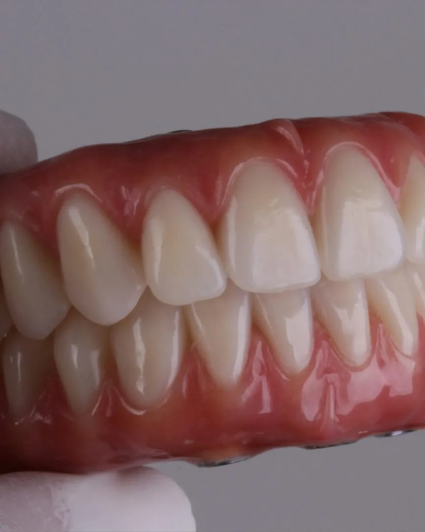 Prótese protocolo pronta, com dentes e gengiva artificial, na mão do dentista